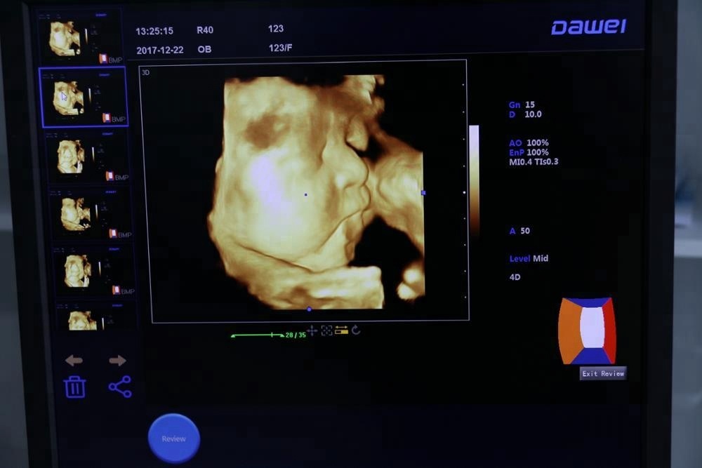 3D/4D COLOR ULTRASOUND MACHINE 3D/4D COLOR ULTRASOUND MACHINE