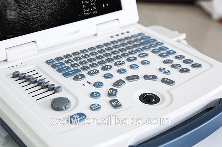 Bas Prix Mini Ordinateur Portable NOUVEAU Plein Numerique Portable Machine A Ultrasons