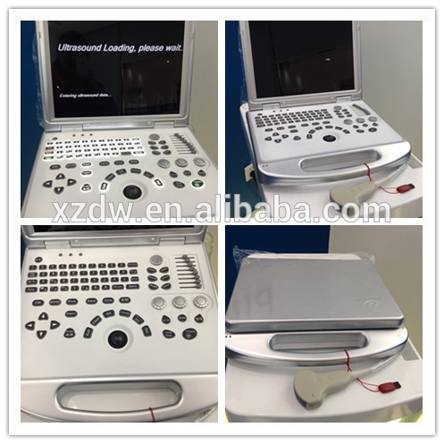 Dawei DW-C60 PLUS color doppler ultrasound scanner PW and 3D function Dawei DW-C60 PLUS color doppler ultrasound scanner PW and 3D function
