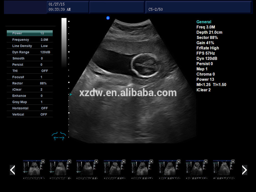 Dawei DW-C60 PLUS color doppler ultrasound scanner PW and 3D function Dawei DW-C60 PLUS color doppler ultrasound scanner PW and 3D function