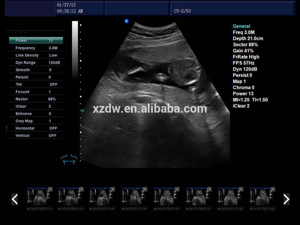 Dawei DW-C60 PLUS color doppler ultrasound scanner PW and 3D function Dawei DW-C60 PLUS color doppler ultrasound scanner PW and 3D function