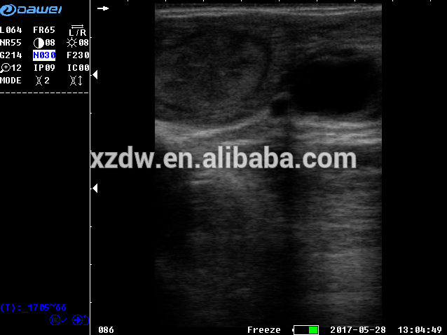 DW-VET6 handheld ultrasound veterinary scanner palm ultrasound DW-VET6 handheld ultrasound veterinary scanner palm ultrasound